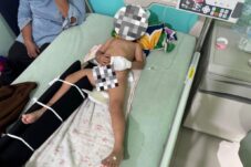 Anak Usia 2 Tahun Kritis Akibat Tabrakan di Sungai Laur Ketapang