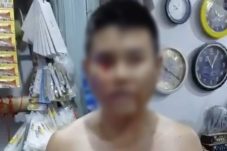Pemuda di Sungai Rengas Diserang di Toko, Mata Terluka Parah